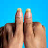 ​Pale or yellow nails