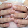 ​White spots