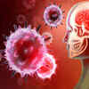 Dementia: Risk Factors
