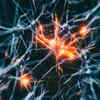 Different forms of Dementia
