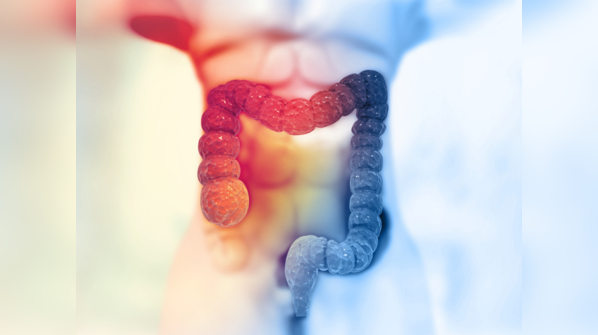 Is there any risk of colon cancer in patients with hemorrhoids?