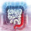 ​Colon cancer and hemorrhoids have similar symptoms