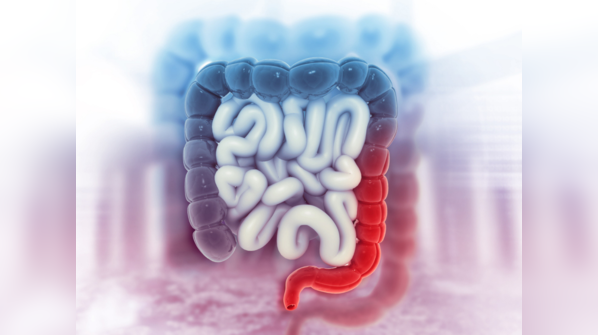 Colon cancer and hemorrhoids have similar symptoms