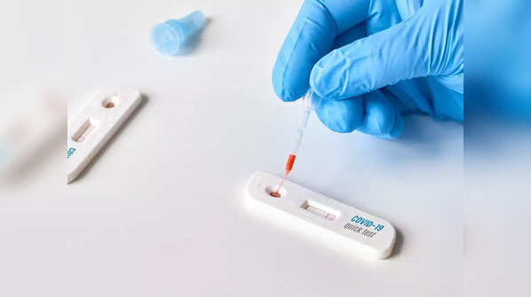 When should someone without any symptoms take a test?