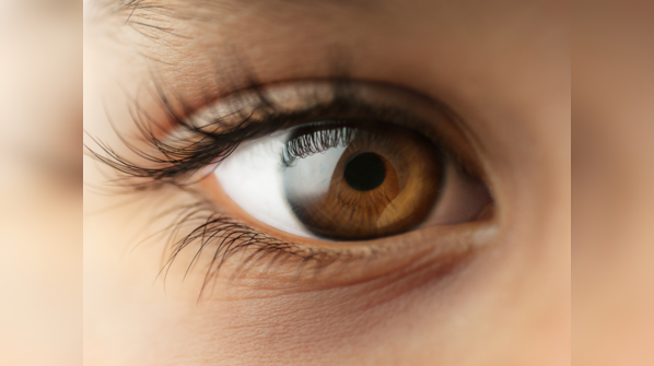 Know about high cholesterol symptoms in eyes