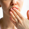 ​Chapped lips