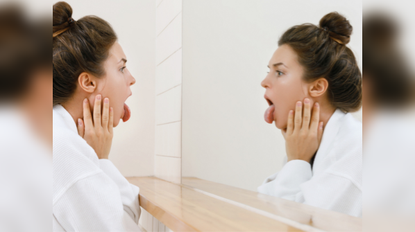Why COVID tongue not being talked about?