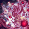 ​Cancer