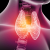 ​Hyperthyroidism