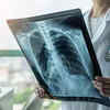 Article image for: How wrong TB diagnosis destroyed three years of my life