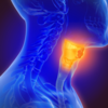 ​Vocal cord neuropathy