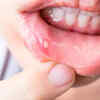 Why is it essential to look for dental signs
