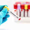 Watch out for other heart-related diseases