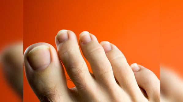 Greek toe