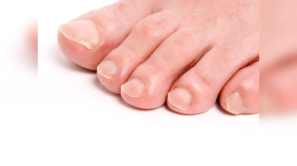 Roman toe