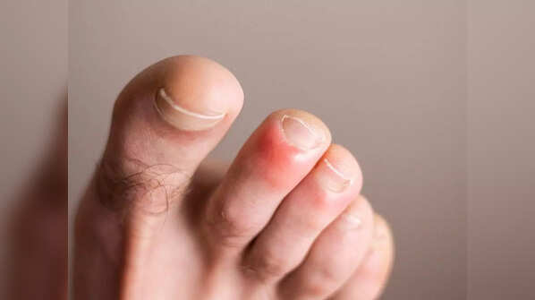 Symptoms to note
