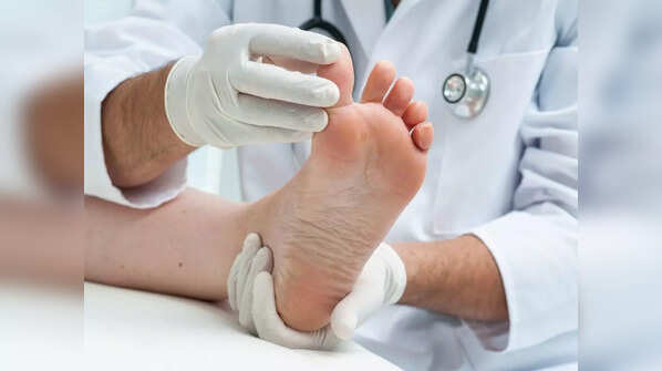 How COVID-19 affects the skin