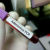 ​What is adenovirus?