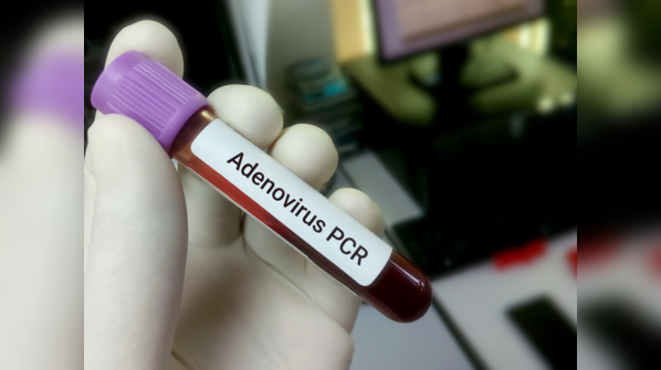 What is adenovirus?
