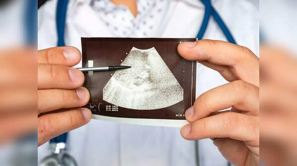 Why are acute hepatitis cases rising among kids?