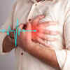 Chest pain and discomfort
