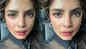 Priyanka Chopra Jonas' bruised face from the sets of 'Citadel' leaves fans worried for her 
