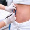 Things considered before surgery