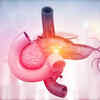 Other symptoms associated with pancreatic cancer