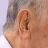 Earlobe crevices may play a role