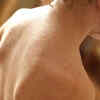 What causes monkeypox vs. COVID-19?