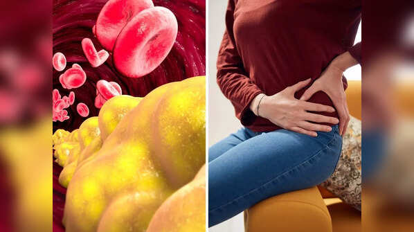 High cholesterol can lead to pain in certain parts of the body