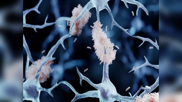 Health problems caused by amyloids