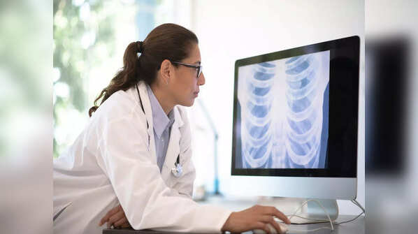 Other symptoms of lung cancer