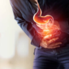 ​COVID and stomach