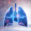 ​COVID and lungs