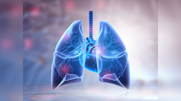 COVID pneumonia is different from general pneumonia with its distinct signs and symptoms