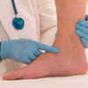 Other symptoms of edema to watch out for