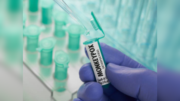 Is monkeypox fatal?