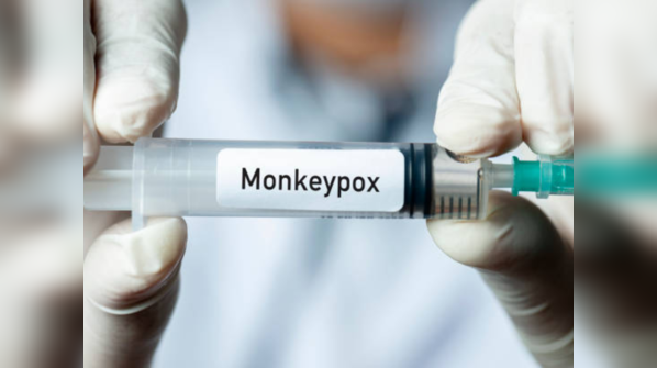 What are the typical symptoms of Monkeypox?