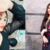 Article image for: Pictures of Kannada actress Swathi Sathish go viral after her <i class="tbold">root canal</i> surgery goes wrong