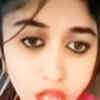 Article image for: Pictures of Kannada actress Swathi Sathish go viral after her <i class="tbold">root canal</i> surgery goes wrong