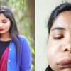 Article image for: Pictures of Kannada actress Swathi Sathish go viral after her <i class="tbold">root canal</i> surgery goes wrong
