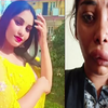 Article image for: Pictures of Kannada actress Swathi Sathish go viral after her <i class="tbold">root canal</i> surgery goes wrong