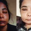 Article image for: Pictures of Kannada actress Swathi Sathish go viral after her <i class="tbold">root canal</i> surgery goes wrong