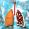 Article image for: What causes <i class="tbold">lung cancer</i>?