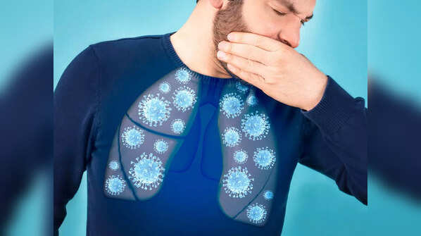 Other ways to treat COVID cough