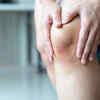 Signs of vitamin K deficiency