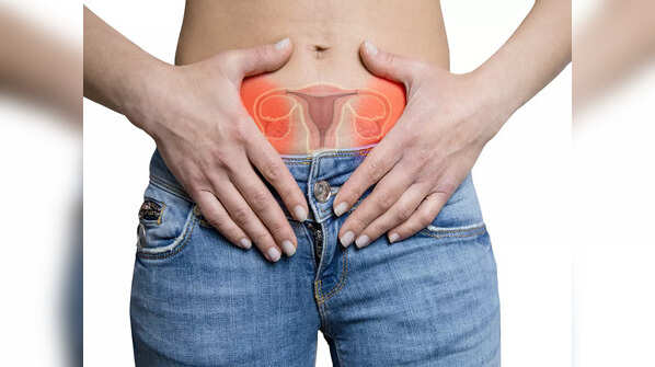 Ovarian cyst