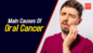 Main causes of oral cancer