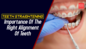 Teeth straightening: Importance of the right alignment of teeth